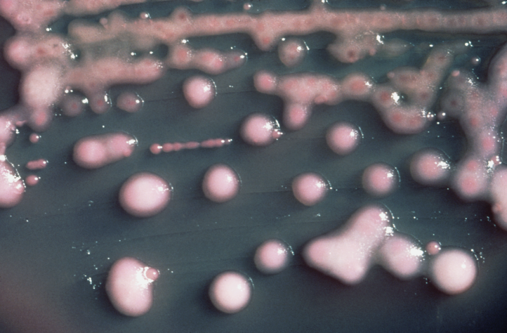 Superbakteria klebsiella pneumoniae
