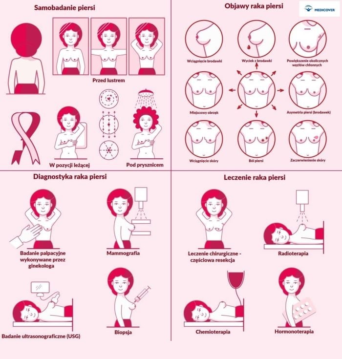 Objawy i leczenie raka piersi