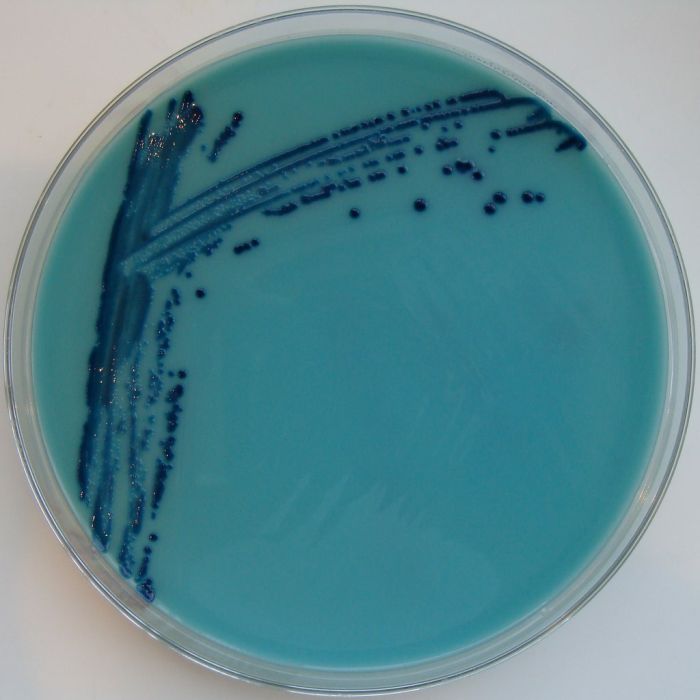 Kultury bakterii Klepsiella pneumoniae