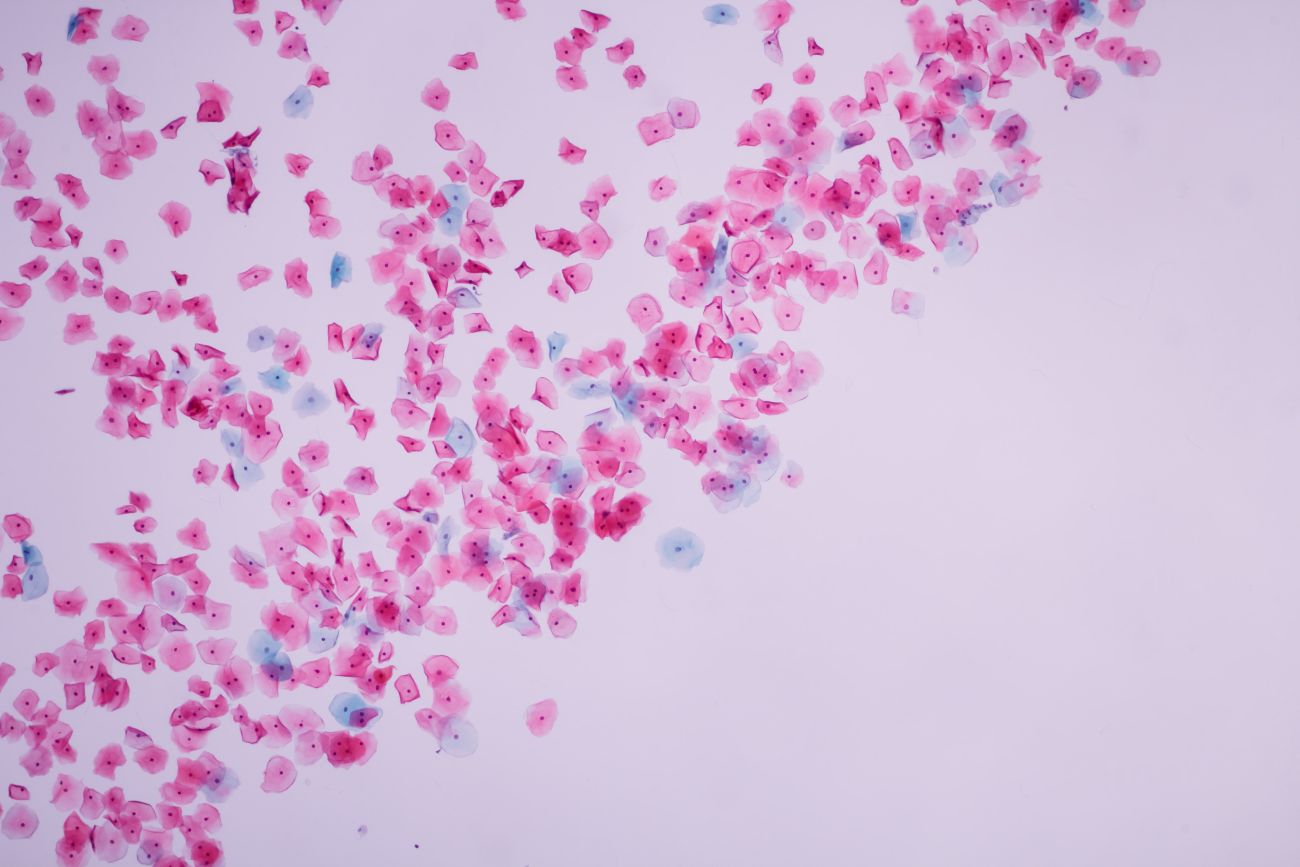 Komórki nabłonkowe szyjki macicy