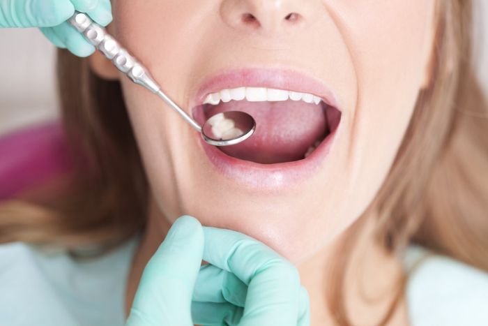 Przed założeniem aparatu ortodontycznego należy wyleczyć wszystkie zęby, które są zaatakowane przez próchnicę