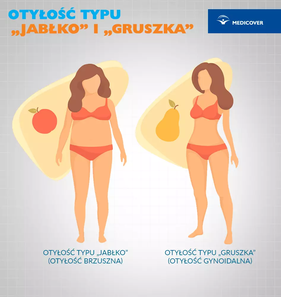 Otyłość typu „jabłko” i typu "gruszka". Różnice między otyłością brzuszną a otyłością otyłość gynoidalną.