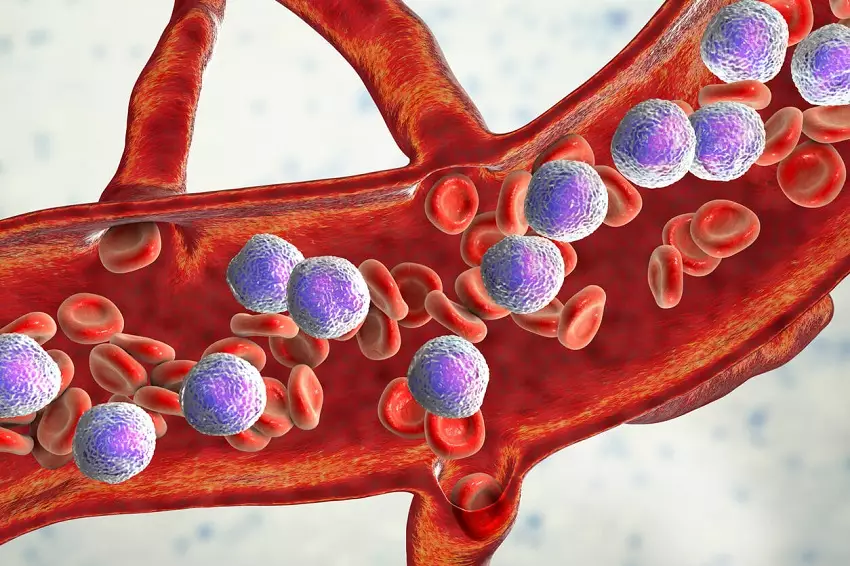  Białaczkami określa się grupę złośliwych nowotworów układu krwiotwórczego.