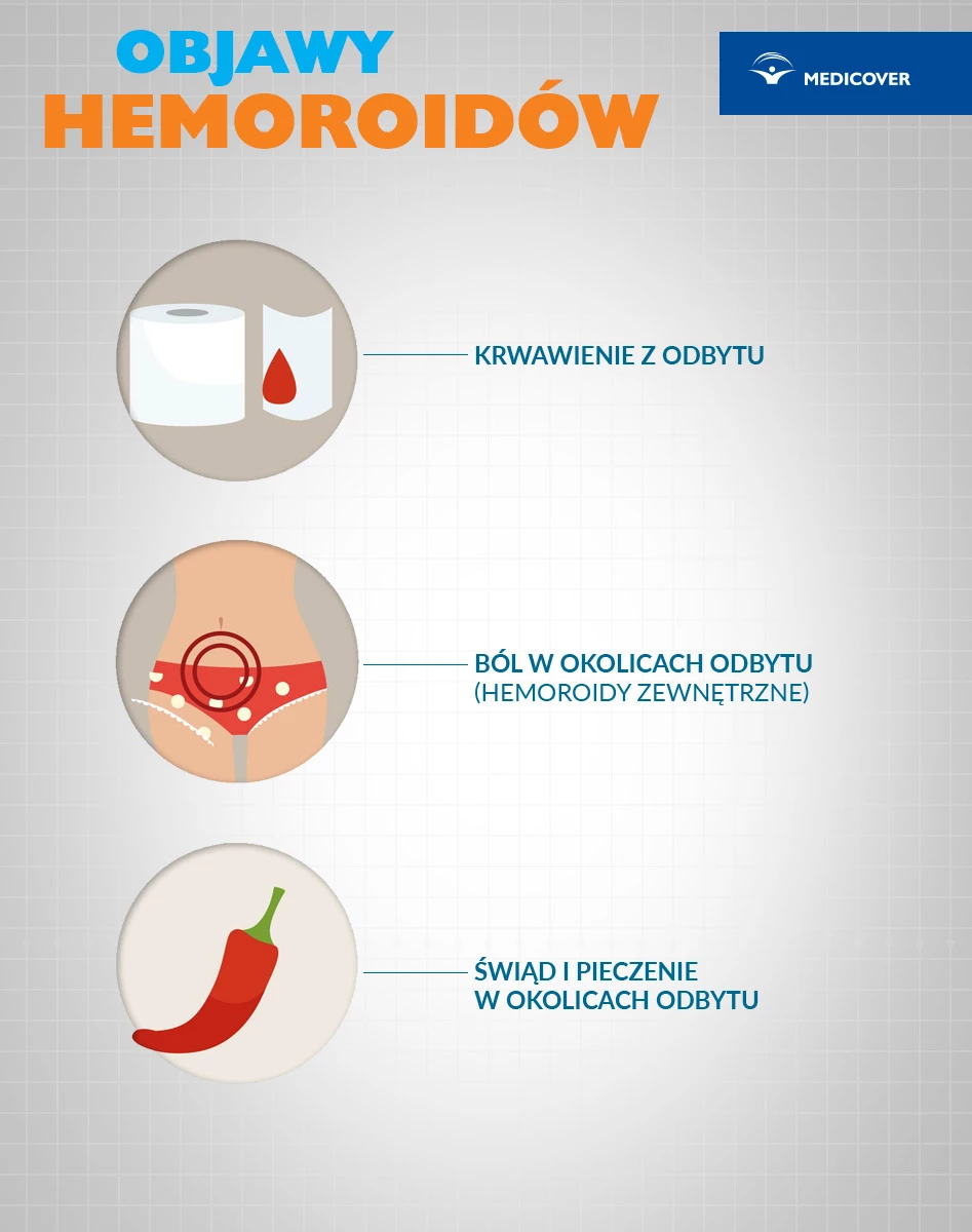 Objawy choroby hemoroidalnej.