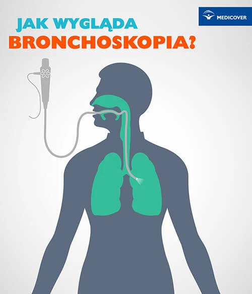 Bronchoskopia jak wygląda badanie?