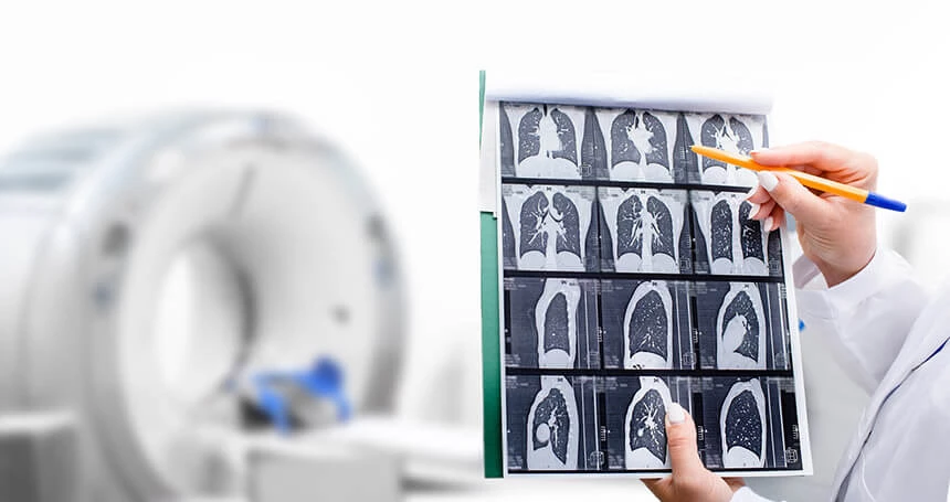 Tomografia komputerowa klatki piersiowej - zdjęcie.