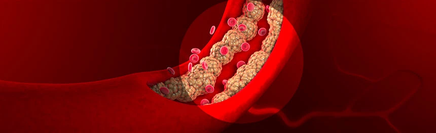Sprawdzenie ilości cholesterolu we krwi powinno być rutynowym badaniem w przypadku prawdopodobieństwa chorób układu sercowo-naczyniowego.