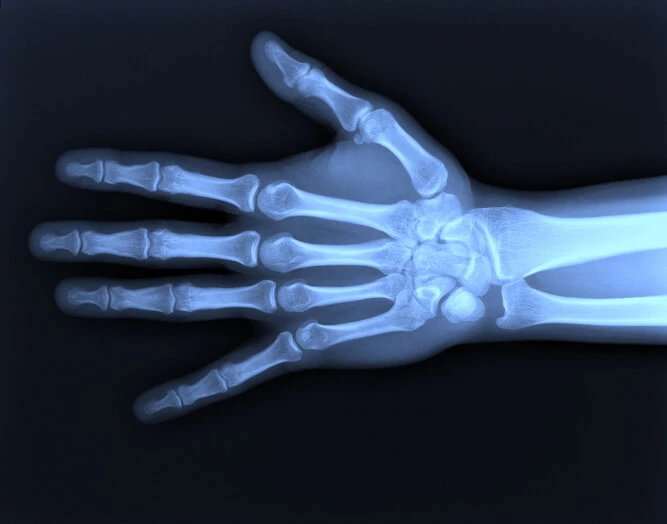 Badanie RTG ręki to jedno z głównych badań wykorzystywanych w ortopedii i traumatologii.