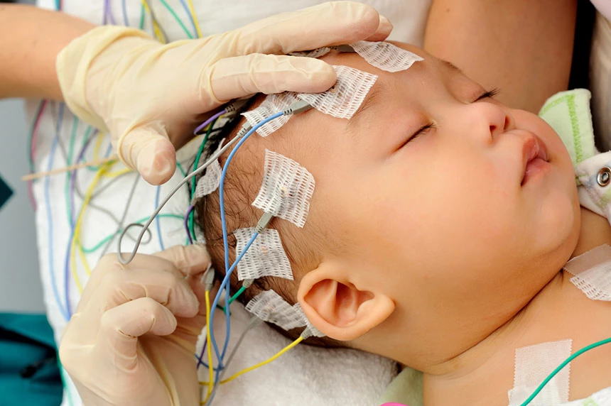 EEG u dziecka przygotowanie powinno pomóc zasnąć małym dzieciom.