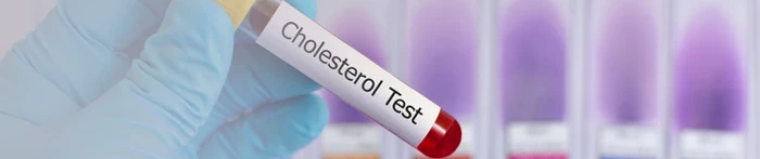 Jaki jest prawidłowy poziom cholesterolu we krwi?