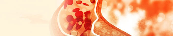 Badanie poziomu cholesterolu całkowitego w Krakowie, gdzie wykonać?