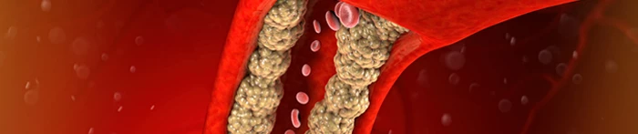 Cholesterol LDL Katowice - badanie z krwi. 
