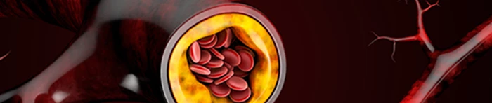 Oznaczenie poziomu cholesterolu LDL.