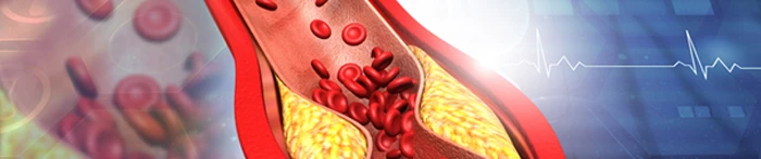 Oznaczenie poziomu cholesterolu frakcji LDL.