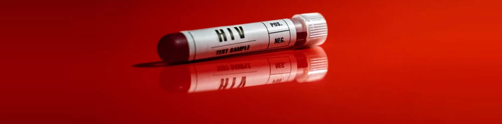 Test w&nbsp;kierunku zakażenia HIV. 