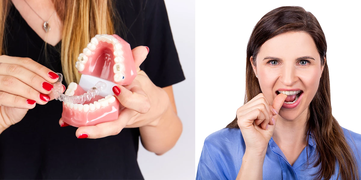 Najbardziej dyskretne leczenie ortodontyczne to Invisalign