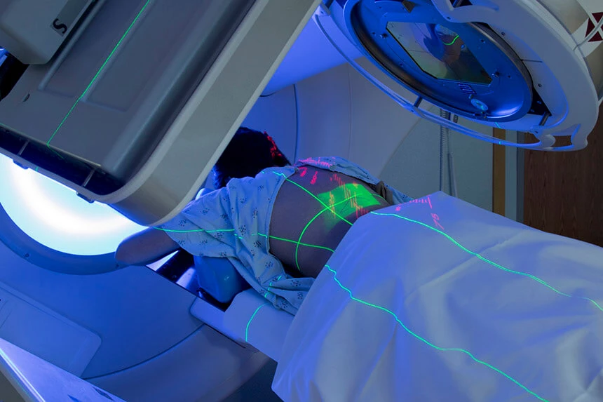 Radioterapia to naświetlanie za pomocą promieniowania jonizującego.