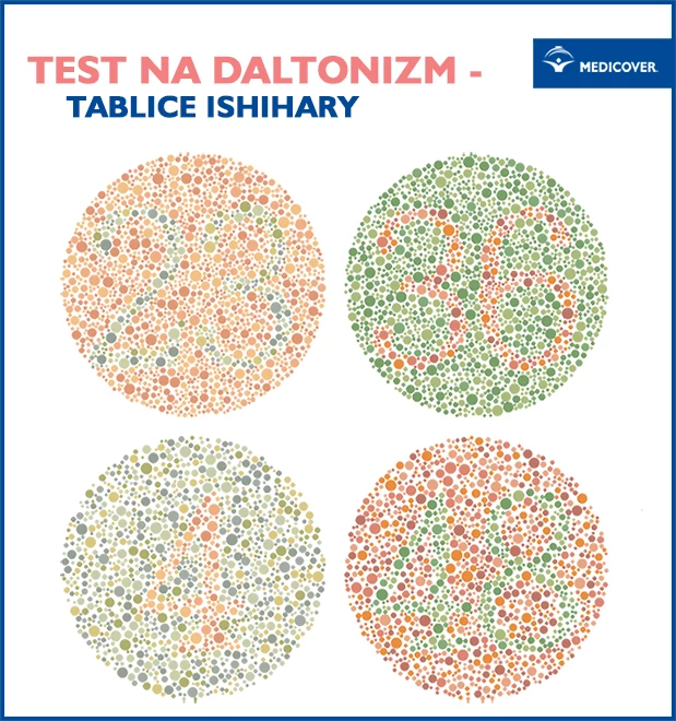  Istnieją różne rodzaje testów na daltonizm. W Polsce wykorzystywane są tablice Ishihary do diagnostyki tego zaburzenia. 