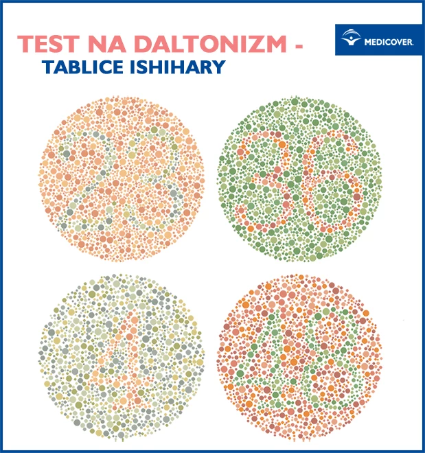  Istnieją r&oacute;żne rodzaje test&oacute;w na daltonizm. W&nbsp;Polsce wykorzystywane są tablice Ishihary do diagnostyki tego zaburzenia.&nbsp;