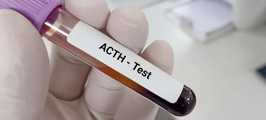 Oznaczenie stężenia ACTH lekarz zleca, podejrzewając np. guzy nadnerczy, guzy przysadki mózgowej. Test robi się także m.in., by rozróżnić nadczynność i niednoczynność nadnerczy.