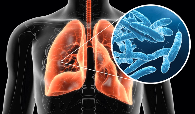 Bakteria z rodzaju Legionella wywołuje choroby układu oddechowego, w tym m.in. ostre zapalenie płuc.