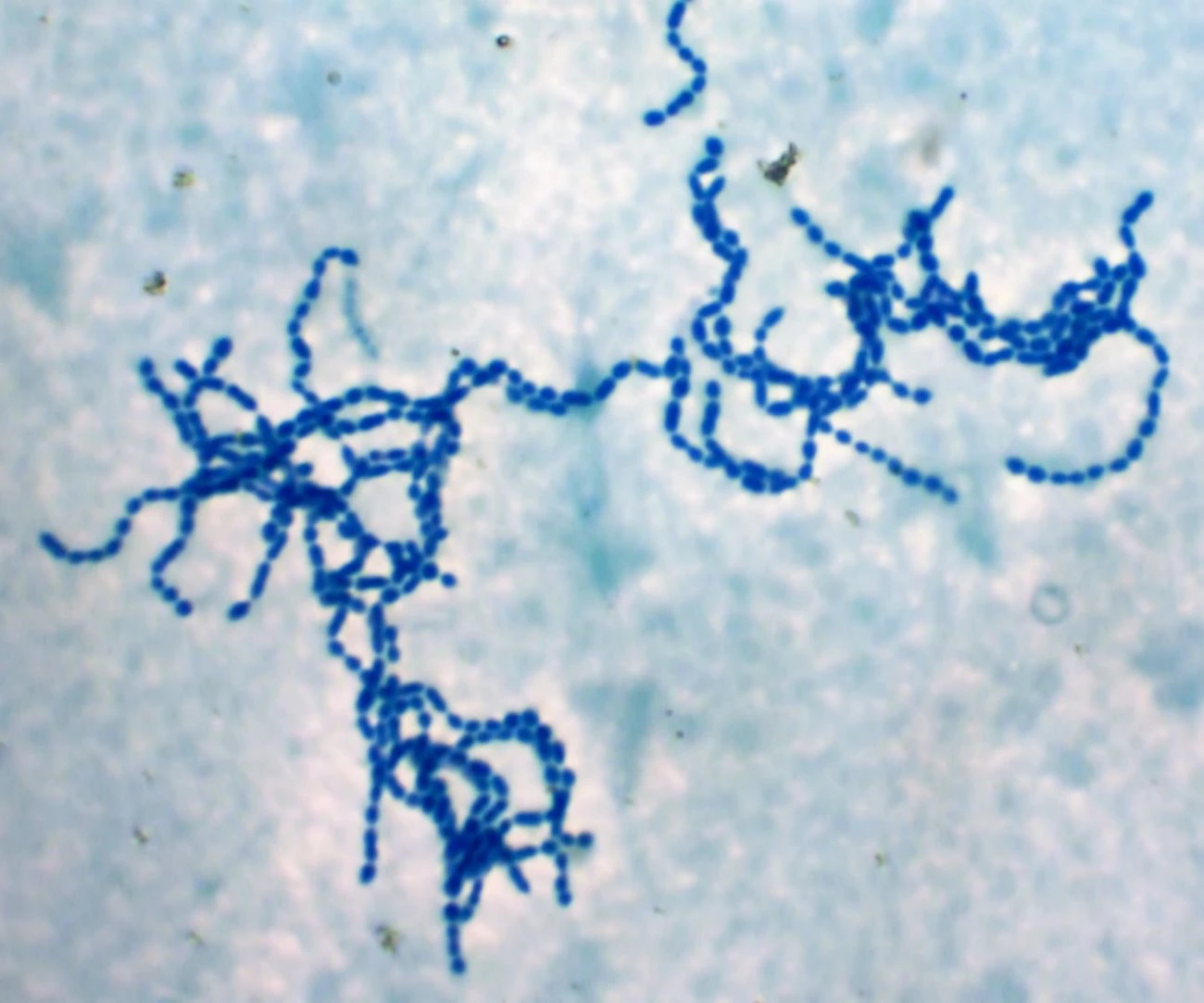 Łańcuchy kom&oacute;rek bakterii Streptococcus pyogenes.