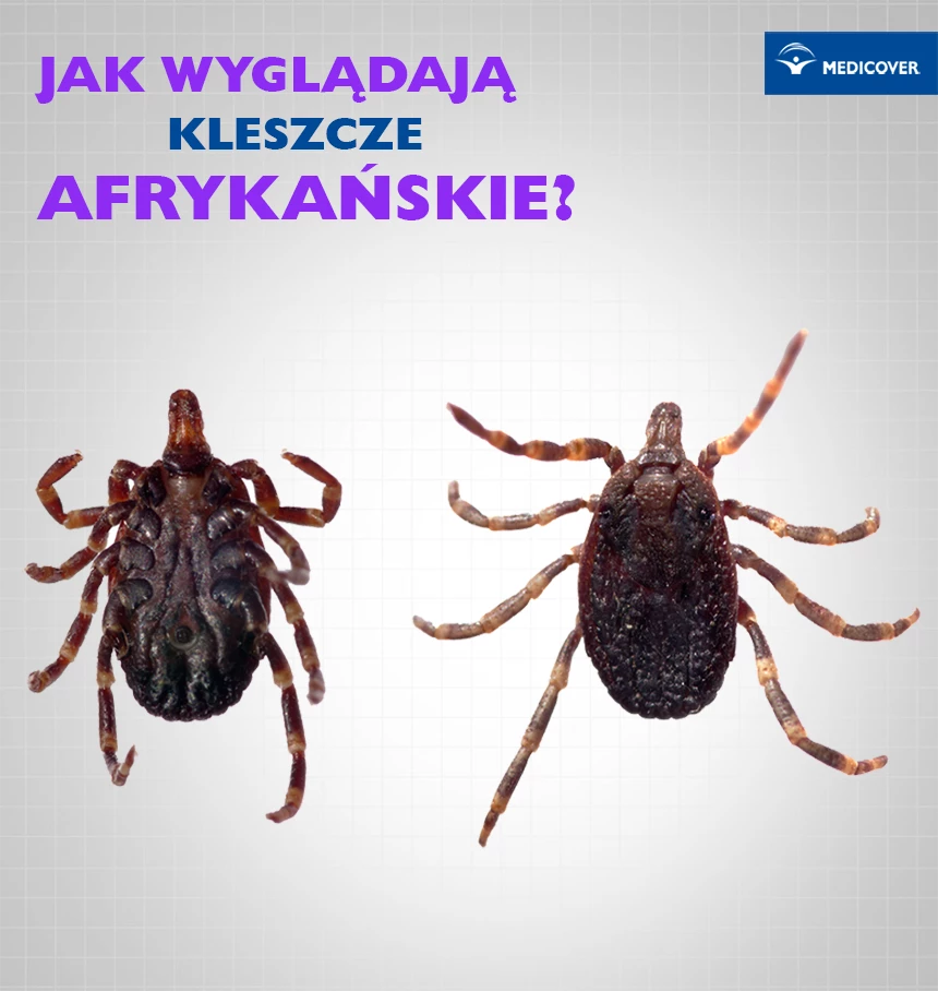 Afrykańskie kleszcze wędrowne łatwo odróżnić od kleszczy zwyczajnych.
