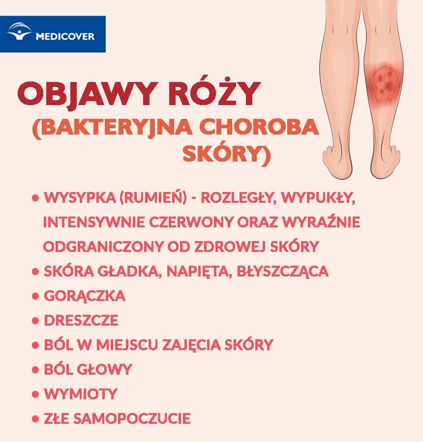 R&oacute;ża charakteryzuje się wystąpieniem zmian sk&oacute;rnych w&nbsp;obrębie twarzy, kończyn dolnych i&nbsp;g&oacute;rnych.&nbsp;