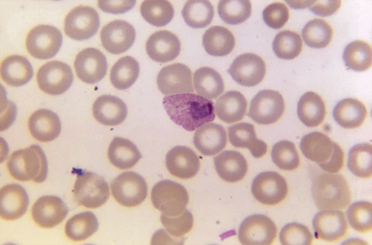 Fotomikrografia cienkiego rozmazu krwi u człowieka, ukazująca dojrzałego pasożyta Plasmodium ovale. Źródło:https://phil.cdc.gov/Details.aspx?pid=21098