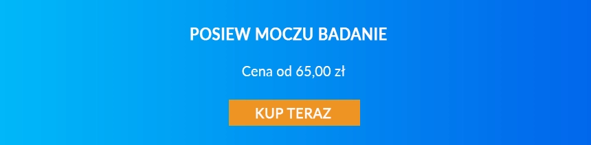 Posiew moczu - cena badania.