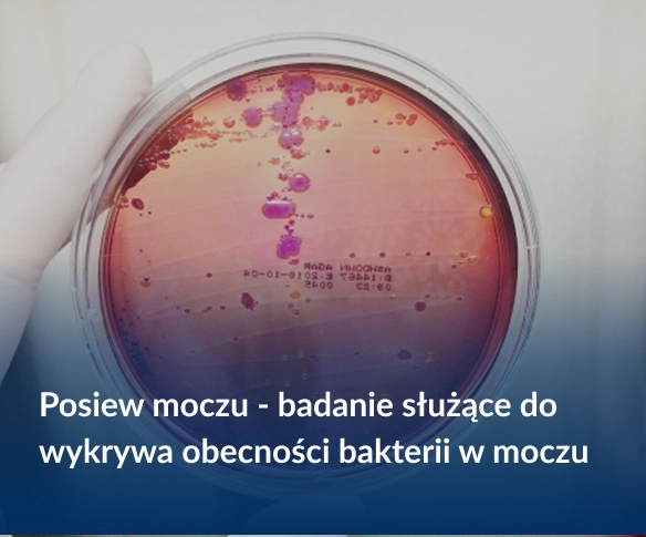 Posiew moczu - badanie służące do wykrywania obecności w moczu. Zdjęcie: Reddress / Shutterstock