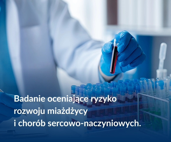 Badanie oceniające ryzyko rozwoju miażdżycy i chorób sercowo-naczyniowych.