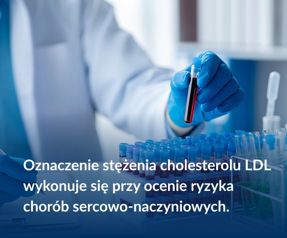 Oznaczenie stężenia cholesterolu LDL wykonuje się przy ocenie ryzyka chor&oacute;b sercowo-naczyniowych.
