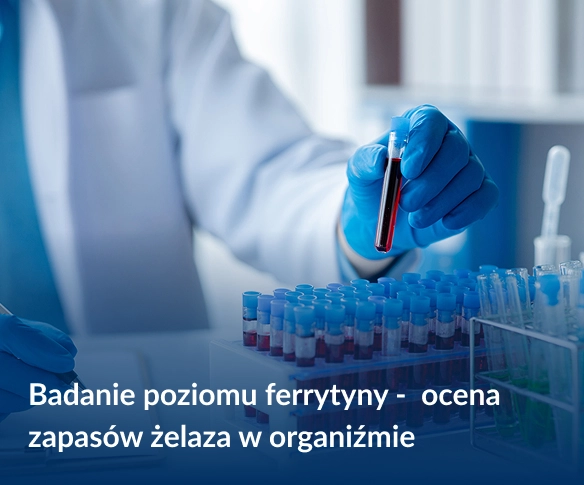 Po co się bada ferrytynę?