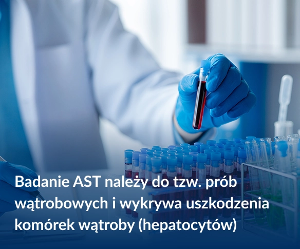 Badanie AST należy do tzw. prób wątrobowych i wykrywa uszkodzenia komórek wątroby (hepatocytów)