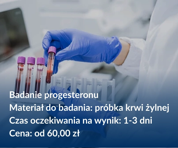 Progesteron - najważniejsze infromacje o&nbsp;badaniu.