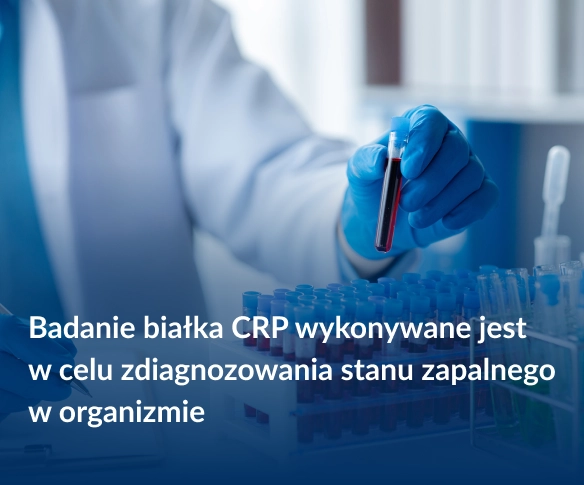 Badanie białka CRP wykonywane jest w celu zdiagnozowania stanu zapalnego w organizmie