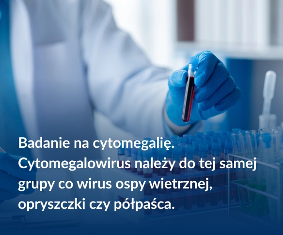 Badanie na cytomegalię. Cytomegalowirus należy do tej samej grupy co wirus ospy wietrznej, opryszczki czy p&oacute;łpaśca.