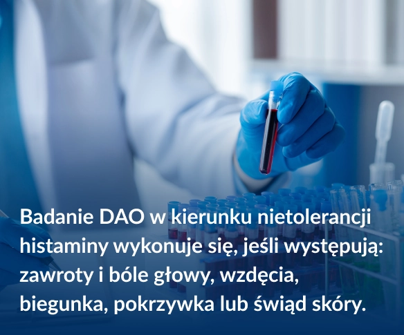 Badanie DAO w&nbsp;kierunku nietolerancji histaminy wykonuje się, jeśli występują: zawroty i&nbsp;b&oacute;le głowy, wzdęcia, biegunka, pokrzywka lub świąd sk&oacute;ry.