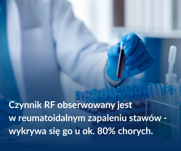 Czynnik RF obserwowany jest w reumatoidalnym zapaleniu stawów - wykrywa się go u ok. 80% chorych.