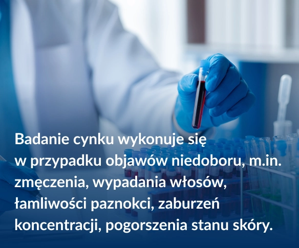 Badanie cynku wykonuje się  w&nbsp;przypadku objaw&oacute;w niedoboru, m.in. zmęczenia, wypadania włos&oacute;w, łamliwości paznokci, zaburzeń koncentracji, pogorszenia stanu sk&oacute;ry.