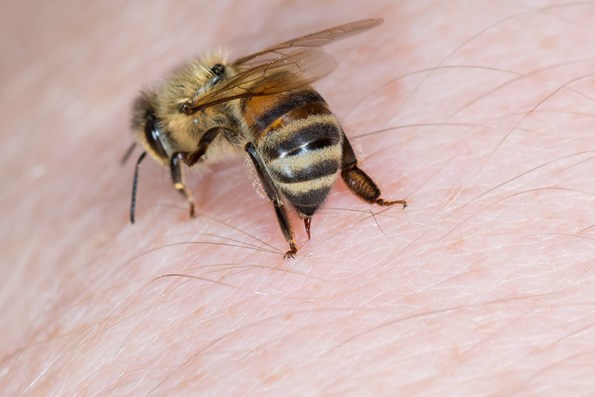 Alergia na jad owadów
