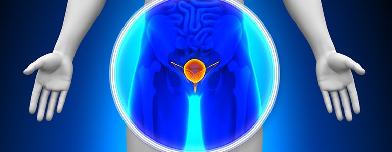 prostatą jak zapobiegać complicație a prostatitei pe rinichi