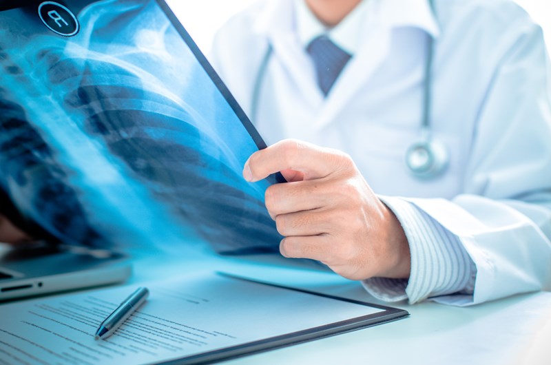 Radiologia - fakty i&nbsp;mity