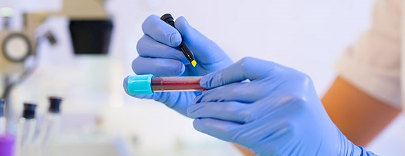 Anemia sierpowata 