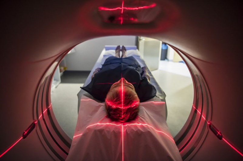 Rezonans magnetyczny (MRI) – kiedy robić rezonans?