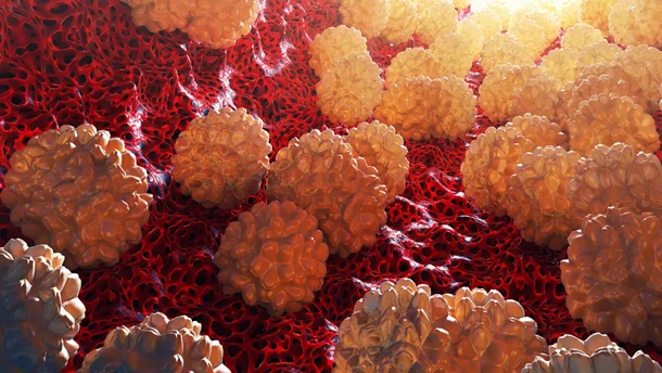chlamydia, chlamydioza