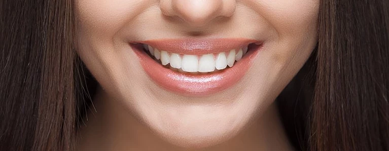 Digital Smile Design (DSD) - cyfrowe projektowanie uśmiechu