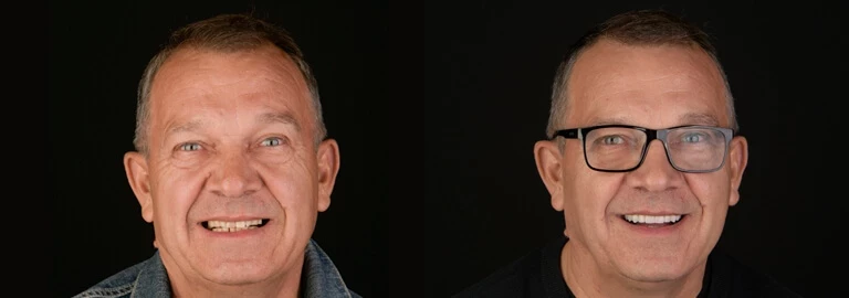 Jeżeli jest ładny uśmiech, wszystko lepiej się układa