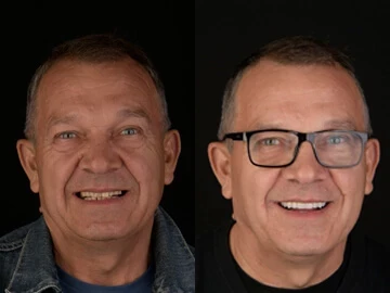 Jeżeli jest ładny uśmiech, wszystko lepiej się układa